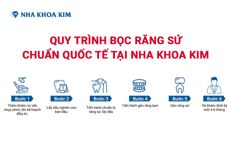 Răng sứ chuẩn quốc tế tại Nha Khoa Kim - Ảnh 1.