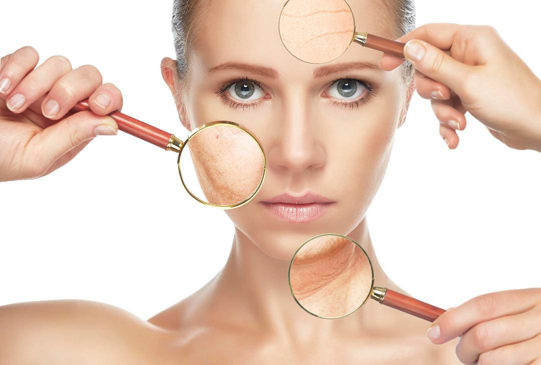 5 &ldquo;s&aacute;t thủ&rdquo; g&acirc;y l&atilde;o h&oacute;a v&agrave; c&aacute;ch điều trị - Ảnh 1.