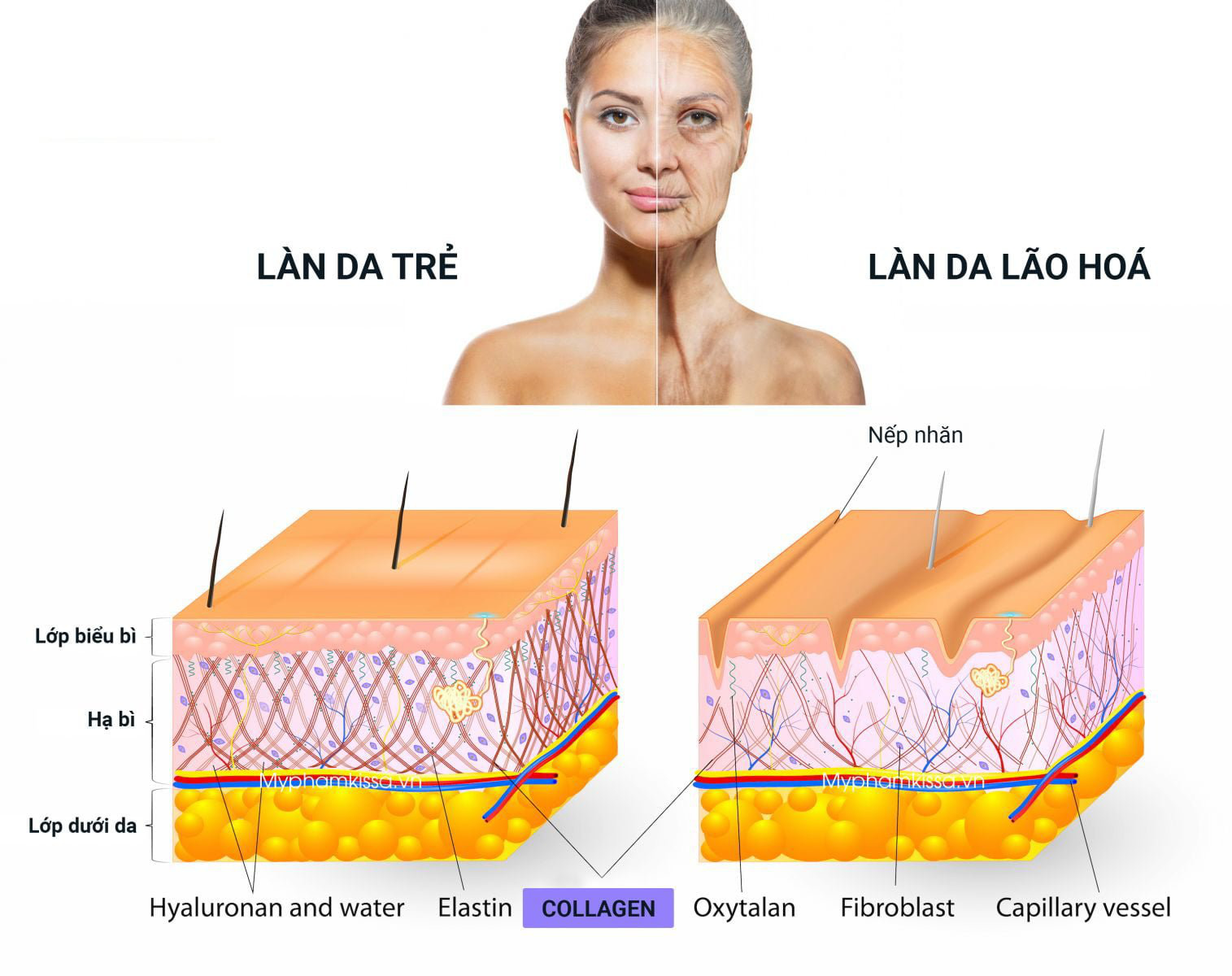 5 &ldquo;s&aacute;t thủ&rdquo; g&acirc;y l&atilde;o h&oacute;a v&agrave; c&aacute;ch điều trị - Ảnh 2.