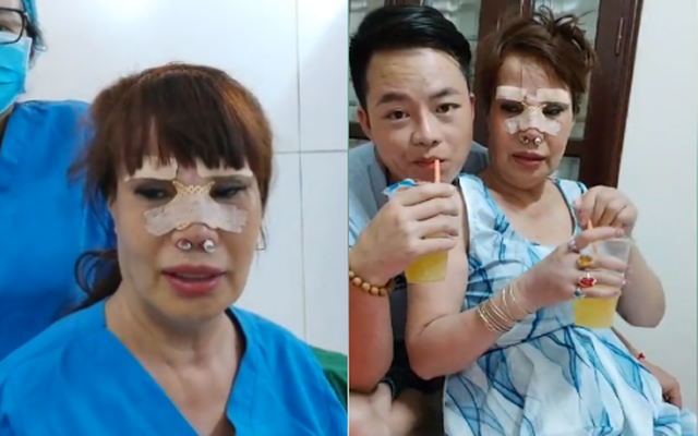Cô dâu 62 tuổi lại tiếp tục phẫu thuật thẩm mỹ, xuất hiện với gương mặt sưng phù khác lạ - Ảnh 1.