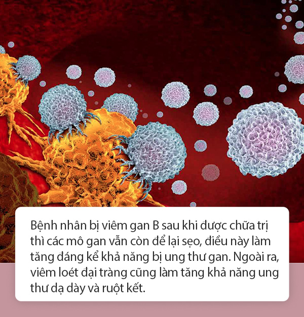 Cứ 6 người bị ung thư thì có 1 người do viêm gây ra, tuyệt đối đừng chủ quan nếu thấy 3 cơ quan này bị viêm - Ảnh 1.