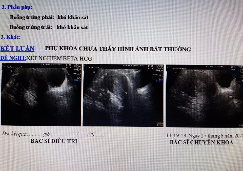 Người phụ nữ nhập viện chờ sinh nhận thông báo không mang thai tiết lộ những thông tin &quot;sốc&quot;?! - Ảnh 2.