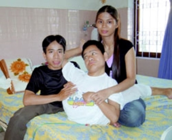 Trước Trúc Nhi - Diệu Nhi, 32 năm về trước Việt Nam từng có một ca phẫu thuật đi vào lịch sử, chứa điểm tương đồng đặc biệt với cặp song sinh này - Ảnh 3. Trước Trúc Nhi - Diệu Nhi, 32 năm về trước Việt Nam từng có một ca phẫu thuật đi vào lịch sử, chứa điểm tương đồng đặc biệt với cặp song sinh này - Ảnh 3.