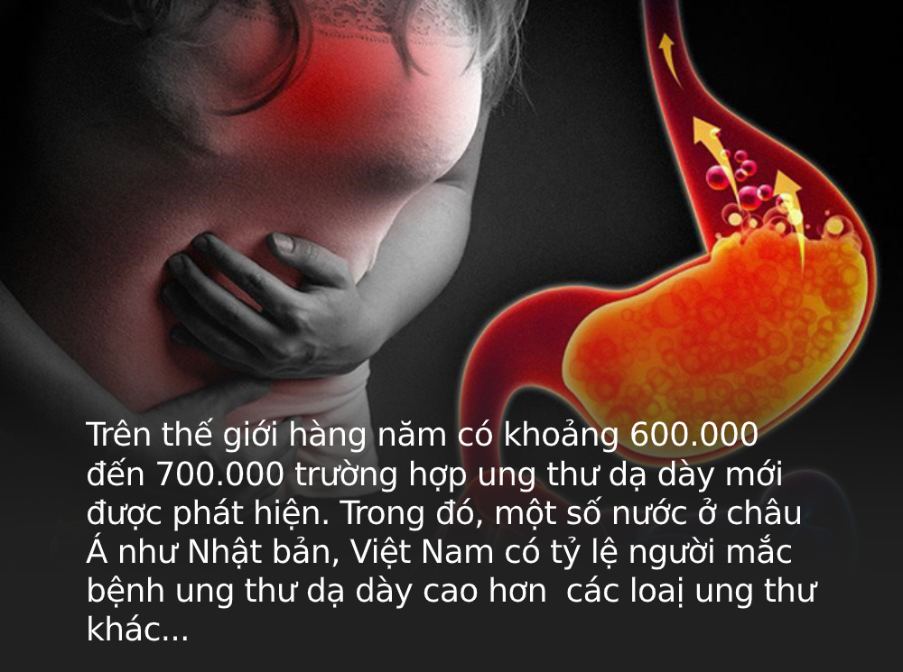 3 dấu hiệu bất thường ở bàn tay cho thấy dạ dày đang &quot;kêu cứu&quot;, ở độ tuổi nào cũng cần làm ngay 4 việc để ngăn cản ung thư hình thành - Ảnh 1.