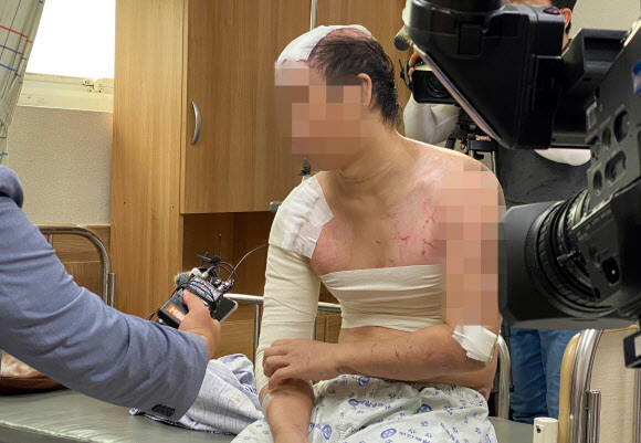 Hàn Quốc: Người đàn ông bị em trai dụ đến ở chung nhà chỉ trong 2 tháng, thân tàn ma dại vì bị hành hạ, đổ nước sôi lên người - Ảnh 2.