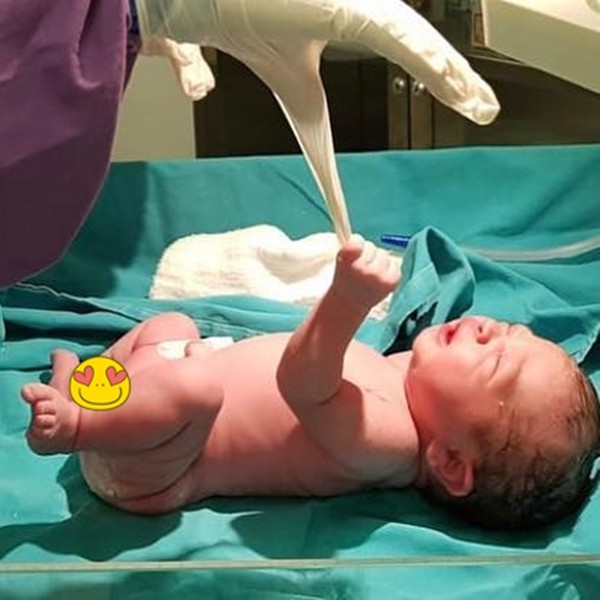 Vừa chào đời, bé sơ sinh đã kéo rơi cả khẩu trang bác sĩ - Ảnh 4.