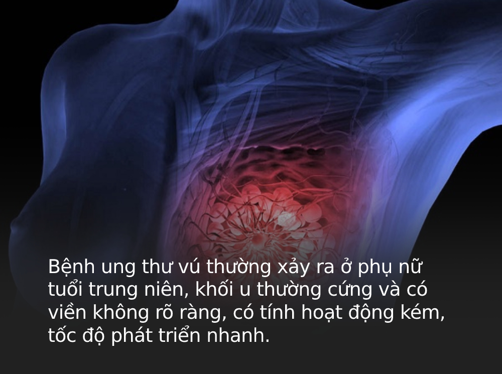 4 loại ung thư dễ chẩn đoán sai nhất, có thể chỉ khác nhau ở một chi tiết cực kỳ nhỏ - Ảnh 4.