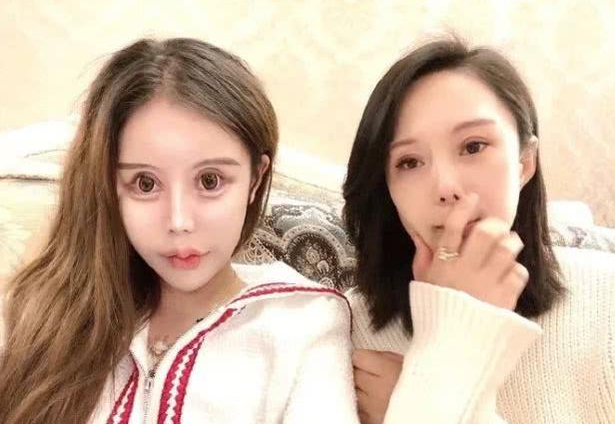 Dân tình khiếp vía khi nhìn gương mặt mẫu nữ Trung Quốc 16 tuổi sau 70 lần phẫu thuật thẩm mỹ, mắt mũi miệng chẳng liên quan đến nhau - Ảnh 3.
