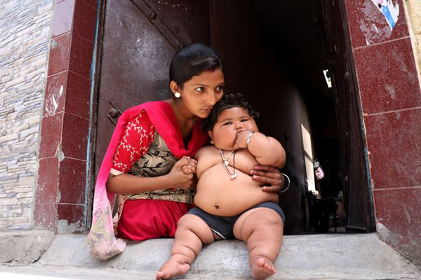 Bé gái ú na ú nần nổi tiếng bất ngờ vì 8 tháng tuổi đã nặng 17kg, diện mạo khi lớn hơn càng gây ngỡ ngàng cho nhiều người - Ảnh 2.