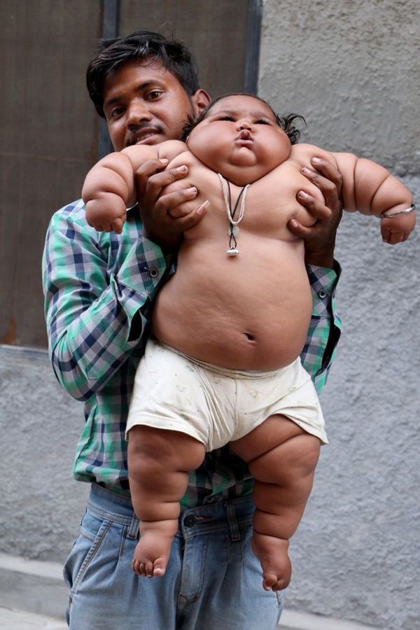 Bé gái ú na ú nần nổi tiếng bất ngờ vì 8 tháng tuổi đã nặng 17kg, diện mạo khi lớn hơn càng gây ngỡ ngàng cho nhiều người - Ảnh 4.