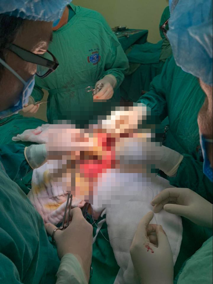 Thay xương bả vai cho bệnh nhi nhỏ tuổi nhất Việt Nam - Ảnh 2.