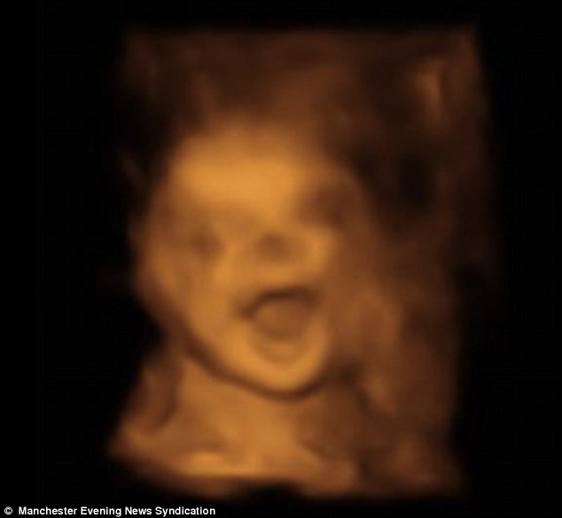 Tan chảy với bức ảnh siêu âm em bé cười toe toét trong bụng mẹ - Ảnh 1.