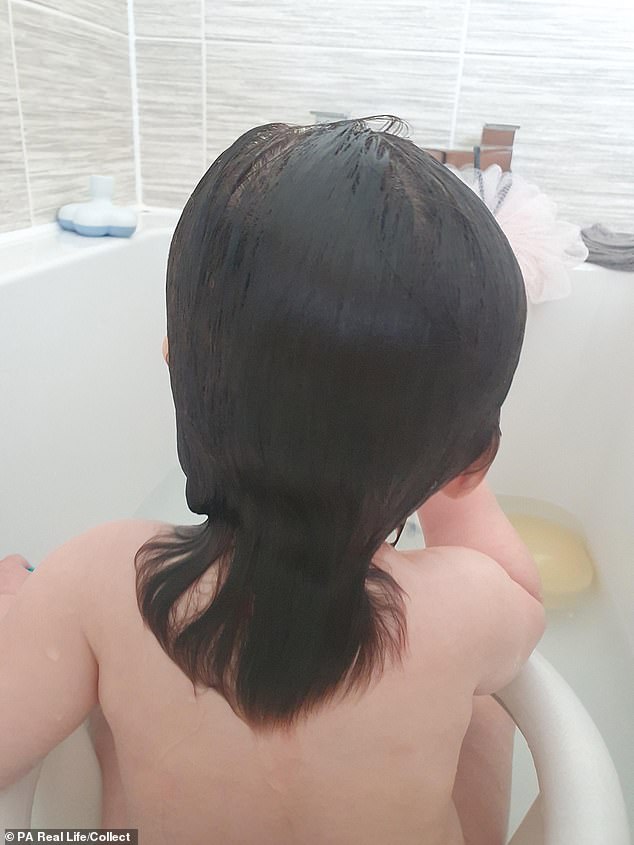 Vừa đỡ em bé ra khỏi bụng mẹ, các y tá đã hét toáng lên "Trời ơi" khi nhìn thấy bộ phận này của đứa trẻ - Ảnh 10. Vừa đỡ em bé ra khỏi bụng mẹ, các y tá đã hét toáng lên "Trời ơi" khi nhìn thấy bộ phận này của đứa trẻ - Ảnh 10.