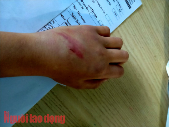 B&eacute; 9 tuổi nghi bị cha bạo h&agrave;nh d&atilde; man - Ảnh 2.