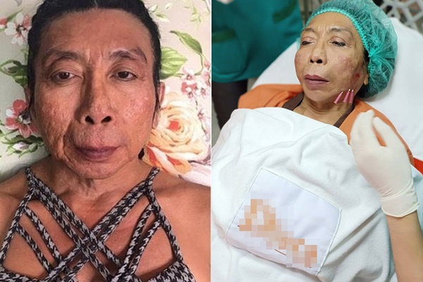 Người phụ nữ chuyển giới Thái Lan khiến cộng đồng mạng khiếp sợ vì nhan sắc ngày càng kinh dị, da sần sùi mốc meo như da trăn - Ảnh 3.