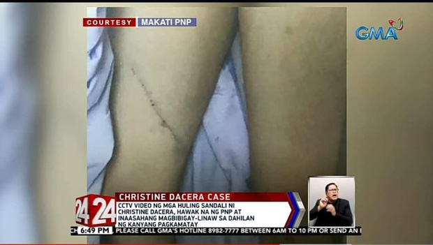 Công bố hình ảnh bầm tím khắp người của Á hậu Philippines, 3 nghi phạm được thả tự do bật khóc nức nở - Ảnh 2.