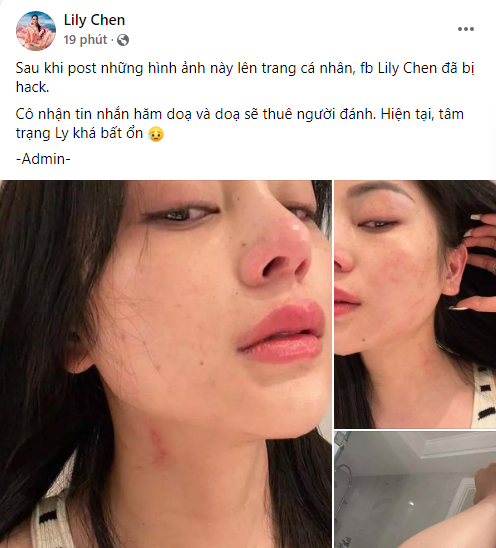 Phỏng vấn nóng: Lily Chen tiếp tục bị đe dọa hành hung, hiện đang bất ổn tâm lý - Ảnh 2.