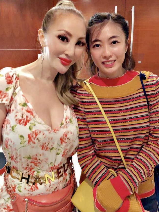Mỹ nhân Hoa ngữ nhận kết đắng vì đam mê "dao kéo" - Ảnh 17. Mỹ nhân Hoa ngữ nhận kết đắng vì đam mê "dao kéo" - Ảnh 17.