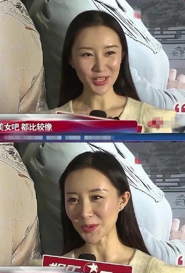 Mỹ nhân Hoa ngữ nhận kết đắng vì đam mê "dao kéo" - Ảnh 3. Mỹ nhân Hoa ngữ nhận kết đắng vì đam mê "dao kéo" - Ảnh 3.