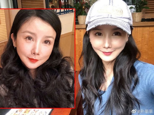 Mỹ nhân Hoa ngữ nhận kết đắng vì đam mê "dao kéo" - Ảnh 5. Mỹ nhân Hoa ngữ nhận kết đắng vì đam mê "dao kéo" - Ảnh 5.