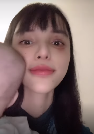 Tình hình hiện tại của nữ siêu mẫu tố chồng sắp cưới bạo hành, gương mặt khiến công chúng xót xa - Ảnh 3.