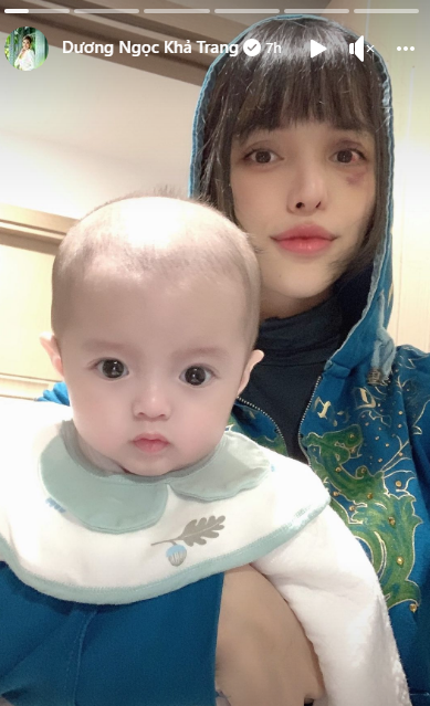 Tình hình hiện tại của nữ siêu mẫu tố chồng sắp cưới bạo hành, gương mặt khiến công chúng xót xa - Ảnh 2.