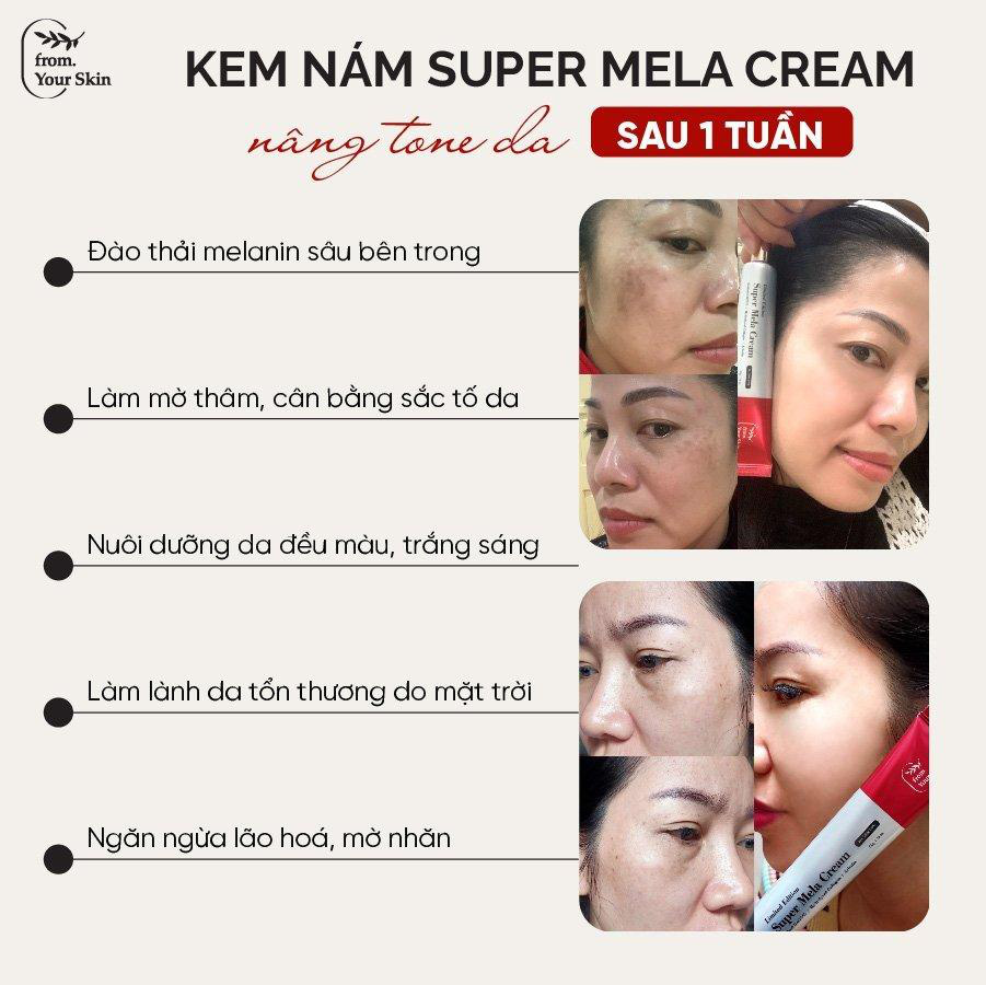 Cách nhận biết kem trị nám Super Mela Cream của From. Your Skin để tránh mua phải hàng nhái - Ảnh 2.