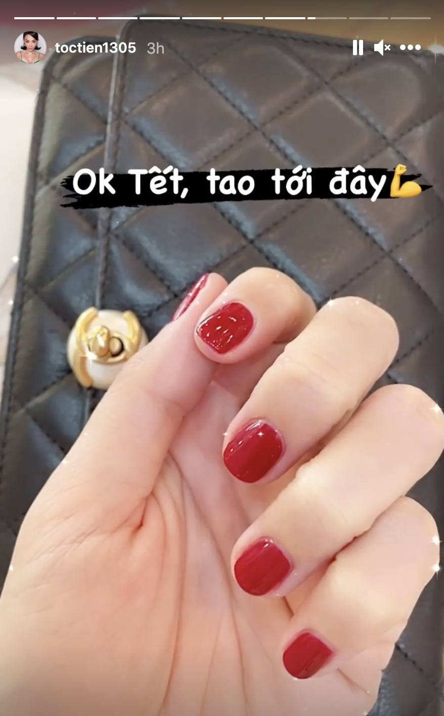 Những ngôi sao Việt đang yêu thích và chọn lựa nails đón tết 2024 tại địa chỉ làm nail của chúng tôi. Thật tuyệt vời khi được trở thành người đầu tiên sở hữu những bộ nails được các sao yêu thích và lựa chọn.