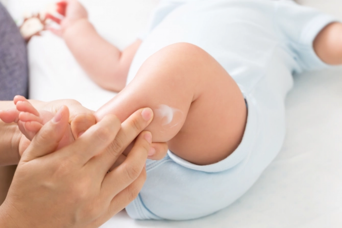 Cảnh báo dưỡng ẩm cho bé có thể làm tăng nguy cơ mắc chứng dị ứng - Ảnh 1.