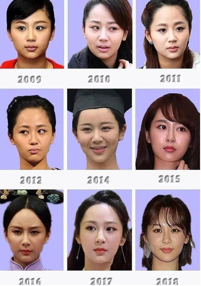 Dương Tử vướng tin đồn phẫu thuật thẩm mỹ vì gương mặt khác lạ theo thời gian.