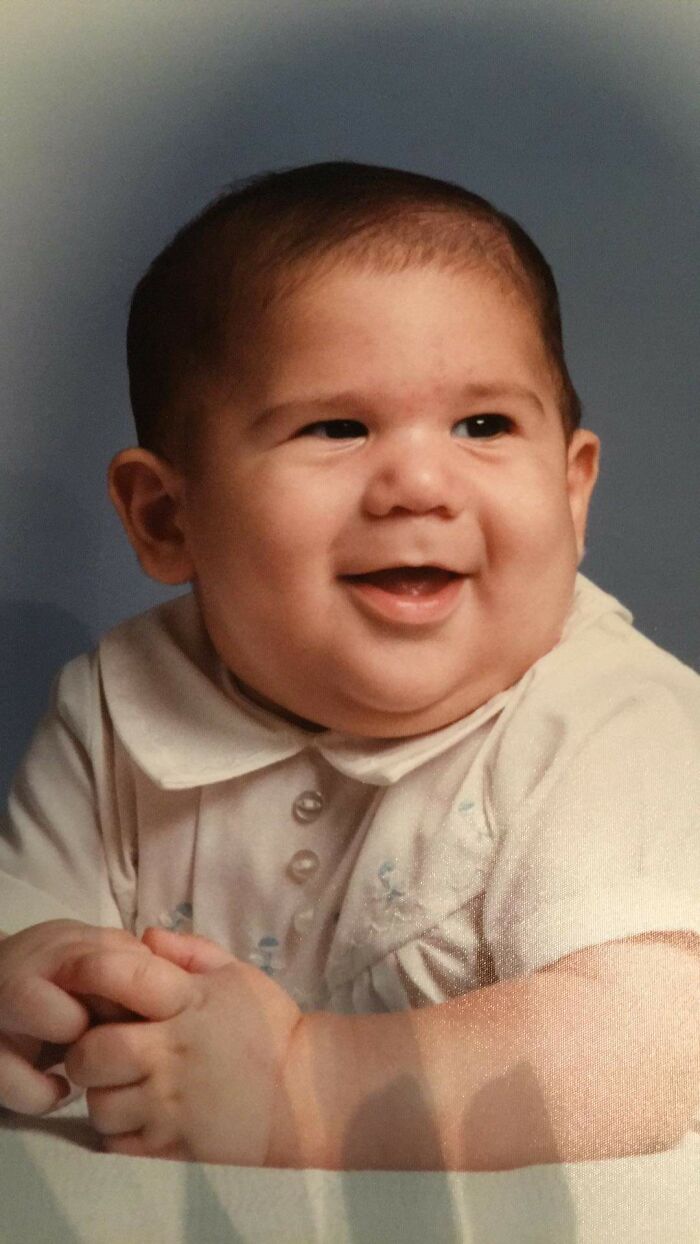 Ch&ugrave;m ảnh: Những em b&eacute; sơ sinh c&oacute; khu&ocirc;n mặt &ldquo;gi&agrave; như tr&aacute;i c&agrave;&rdquo; khiến cha mẹ được một phen &ldquo;hết hồn&rdquo; nhưng lại g&acirc;y b&atilde;o mạng thế giới - Ảnh 14.