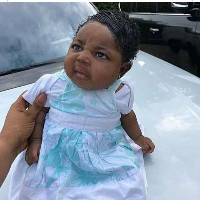 Ch&ugrave;m ảnh: Những em b&eacute; sơ sinh c&oacute; khu&ocirc;n mặt &ldquo;gi&agrave; như tr&aacute;i c&agrave;&rdquo; khiến cha mẹ được một phen &ldquo;hết hồn&rdquo; nhưng lại g&acirc;y b&atilde;o mạng thế giới - Ảnh 4.