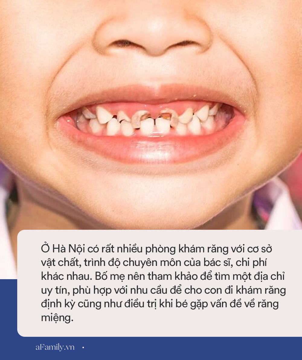 Địa chỉ khám răng cho bé ở Hà Nội: Mách bố mẹ 8 phòng khám uy tín kèm chi phí cụ thể, đỡ mất công đi hỏi khắp nơi - Ảnh 6.