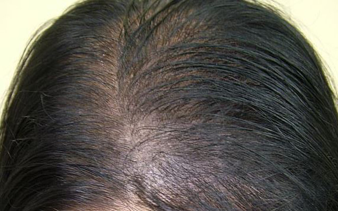 Những dấu hiệu cho thấy mái tóc đang đòi quyền bình đẳng và được chăm sóc kỹ càng hơn - Ảnh 2.
