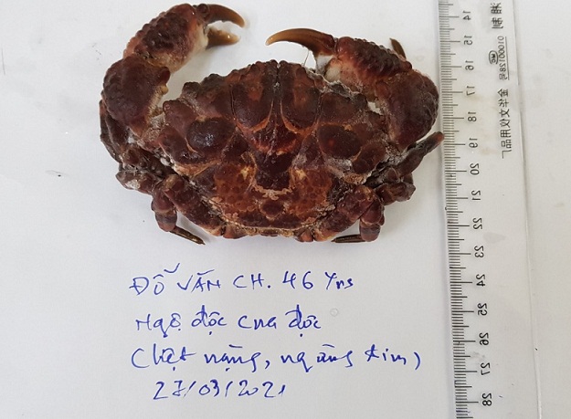 Ăn cua mặt quỷ, một ngư dân bị ngộ độc nguy kịch - Ảnh 2. Ăn cua mặt quỷ, một ngư dân bị ngộ độc nguy kịch - Ảnh 2.