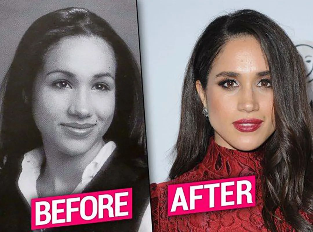 Meghan Markle bị lục lại ảnh cũ, nghi vấn thẩm mĩ nhan sắc rõ mồn một: Sống mũi &quot;giả trân&quot;  - Ảnh 3.