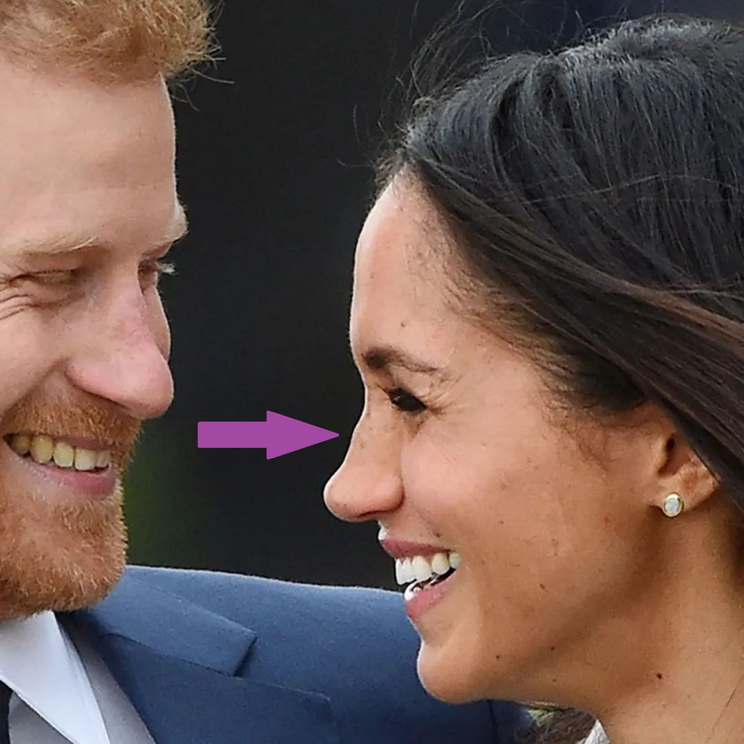 Meghan Markle bị lục lại ảnh cũ, nghi vấn thẩm mĩ nhan sắc rõ mồn một: Sống mũi &quot;giả trân&quot;  - Ảnh 6.