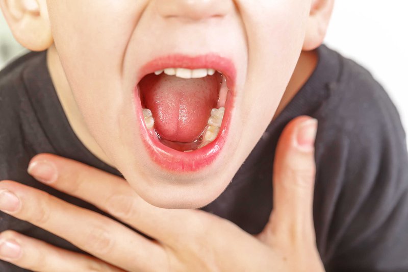 Thấy con gái càng lớn càng xấu, răng mọc không đầu, bố mẹ đưa đi khám thì không ngờ con mắc căn bệnh mà nguyên nhân do 1 thói quen lúc ngủ - Ảnh 4. Cha mẹ hãy coi chừng, thói quen này khi ngủ có thể khiến trẻ ngày càng xấu đi - Ảnh 3.
