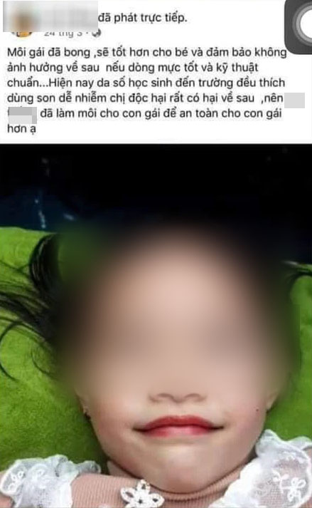 Từ chuyện bé 5 tuổi phun môi collagen: Phun xăm môi cho trẻ em dẫn đến những hệ lụy gì? - Ảnh 4. Từ chuyện bé 5 tuổi phun môi collagen: Phun xăm môi cho trẻ em dẫn đến những hệ lụy gì? - Ảnh 4.