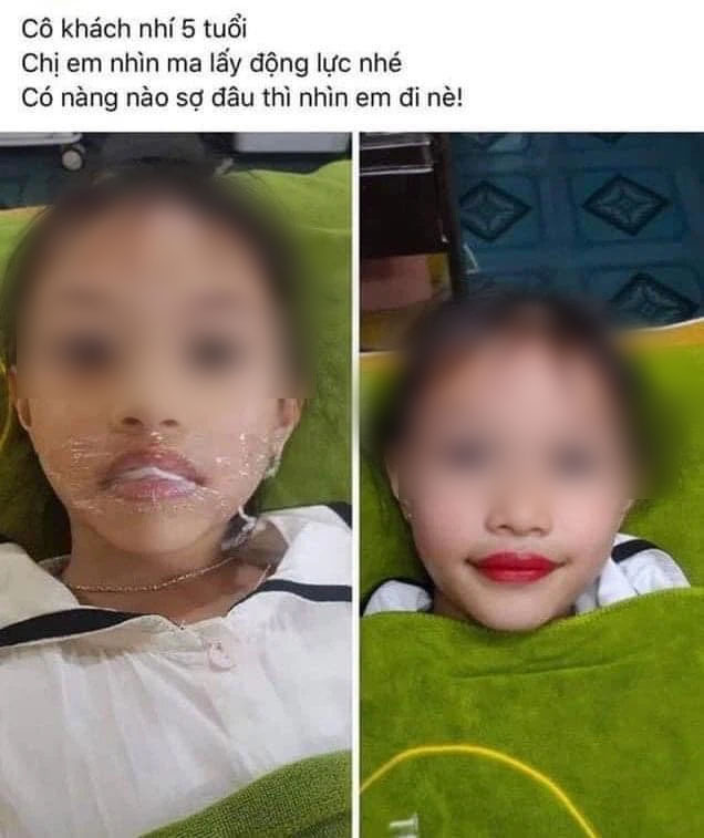 Từ chuyện bé 5 tuổi phun môi collagen: Phun xăm môi cho trẻ em dẫn đến những hệ lụy gì? - Ảnh 5. Từ chuyện bé 5 tuổi phun môi collagen: Phun xăm môi cho trẻ em dẫn đến những hệ lụy gì? - Ảnh 5.