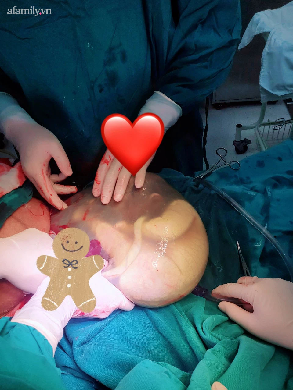 Tận mắt ngắm cảnh ca sinh con đẻ bọc điều cực kỳ hiếm gặp - Ảnh 3.