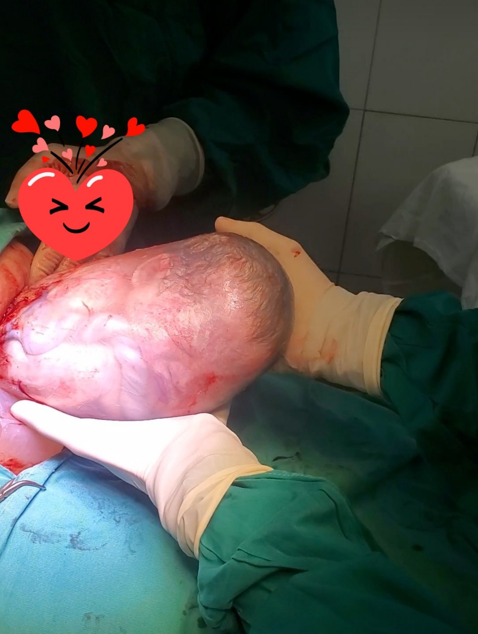 Tận mắt ngắm cảnh c&aacute;c ca sinh con đẻ bọc điều cực kỳ hiếm gặp - Ảnh 8.