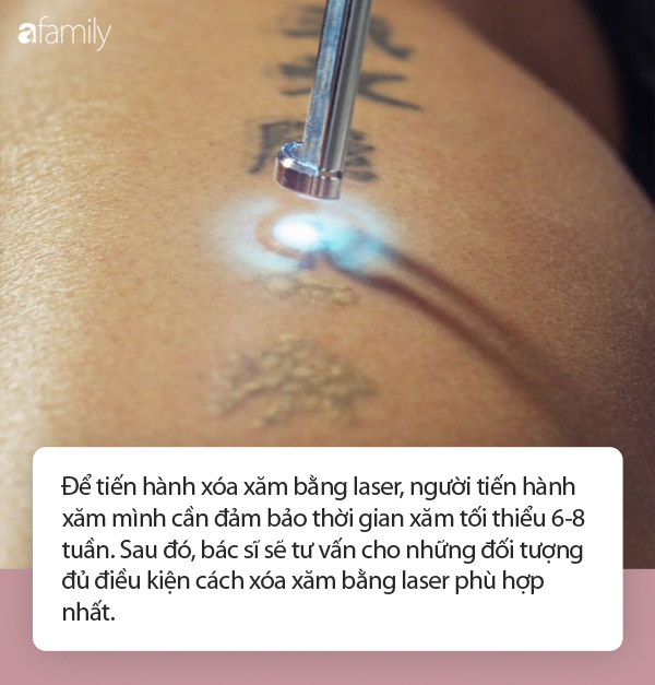 Xóa xăm bằng laser: Từ cách xóa đến biến chứng dễ gặp đều được chuyên gia giải đáp - Ảnh 3. Xóa xăm bằng laser: Từ cách xóa đến biến chứng dễ gặp đều được chuyên gia giải đáp - Ảnh 3.