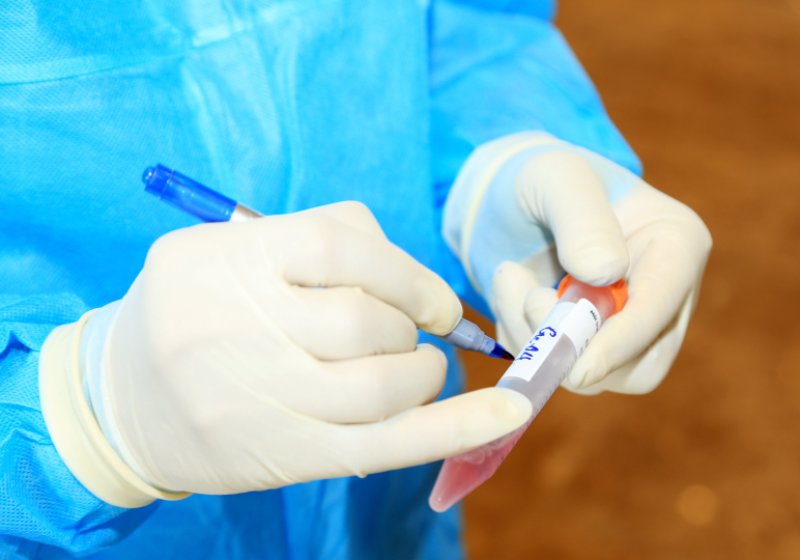 Thêm 3 ca dương tính SARS-COV-2 liên quan cụ ông 74 tuổi thuê thợ về làm cửa - Ảnh 1. Thêm 3 ca dương tính SARS-COV-2 liên quan cụ ông 74 tuổi thuê thợ về làm cửa - Ảnh 1.