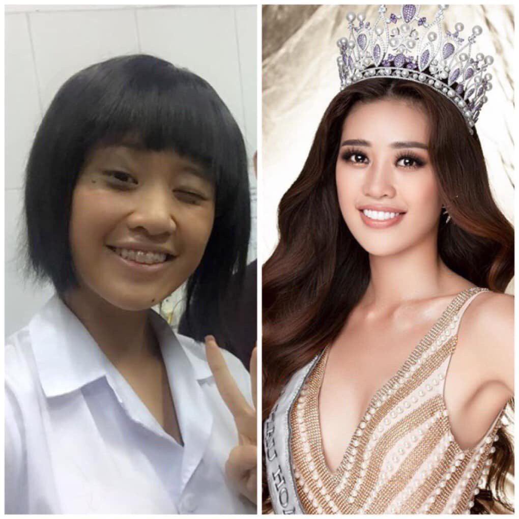 Đâu phải sinh ra đã đẹp, đến Khánh Vân phải chịu khó niềng răng mới hoàn hảo như bây giờ đấy - Ảnh 1. Đâu phải sinh ra đã đẹp, đến Khánh Vân phải chịu khó niềng răng mới hoàn hảo như bây giờ đấy - Ảnh 1.