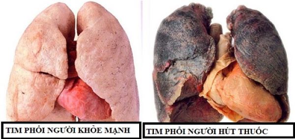 Nguy hiểm của khói thuốc lá trong đại dịch COVID-19 - Ảnh 1.