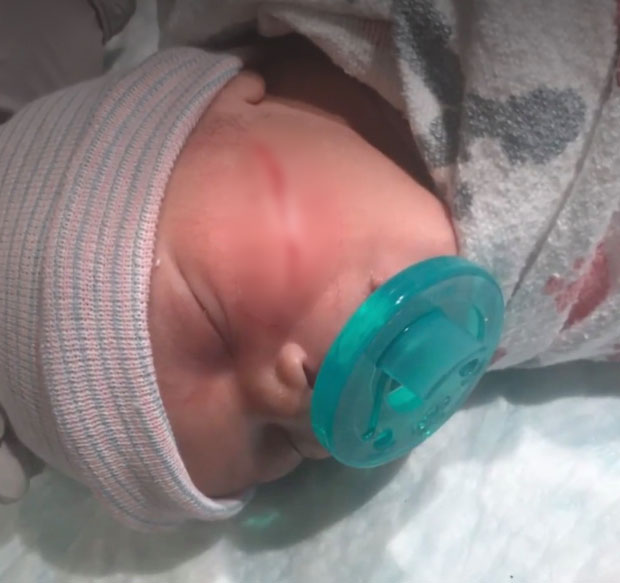 Bé gái vừa chào đời đã phải khâu 13 mũi vì bị bác sĩ rạch vào mặt trong lúc mổ đẻ - Ảnh 1.