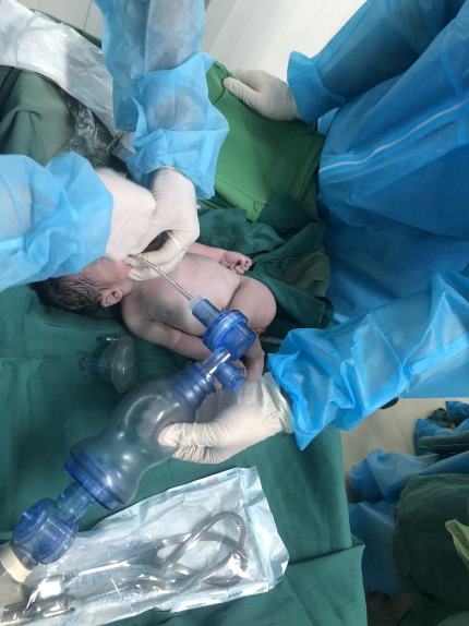 Nghệ An: Phẫu thuật cấp cứu tại khu cách ly cứu sống sản phụ và thai nhi bị rau bong non nguy kịch - Ảnh 2.