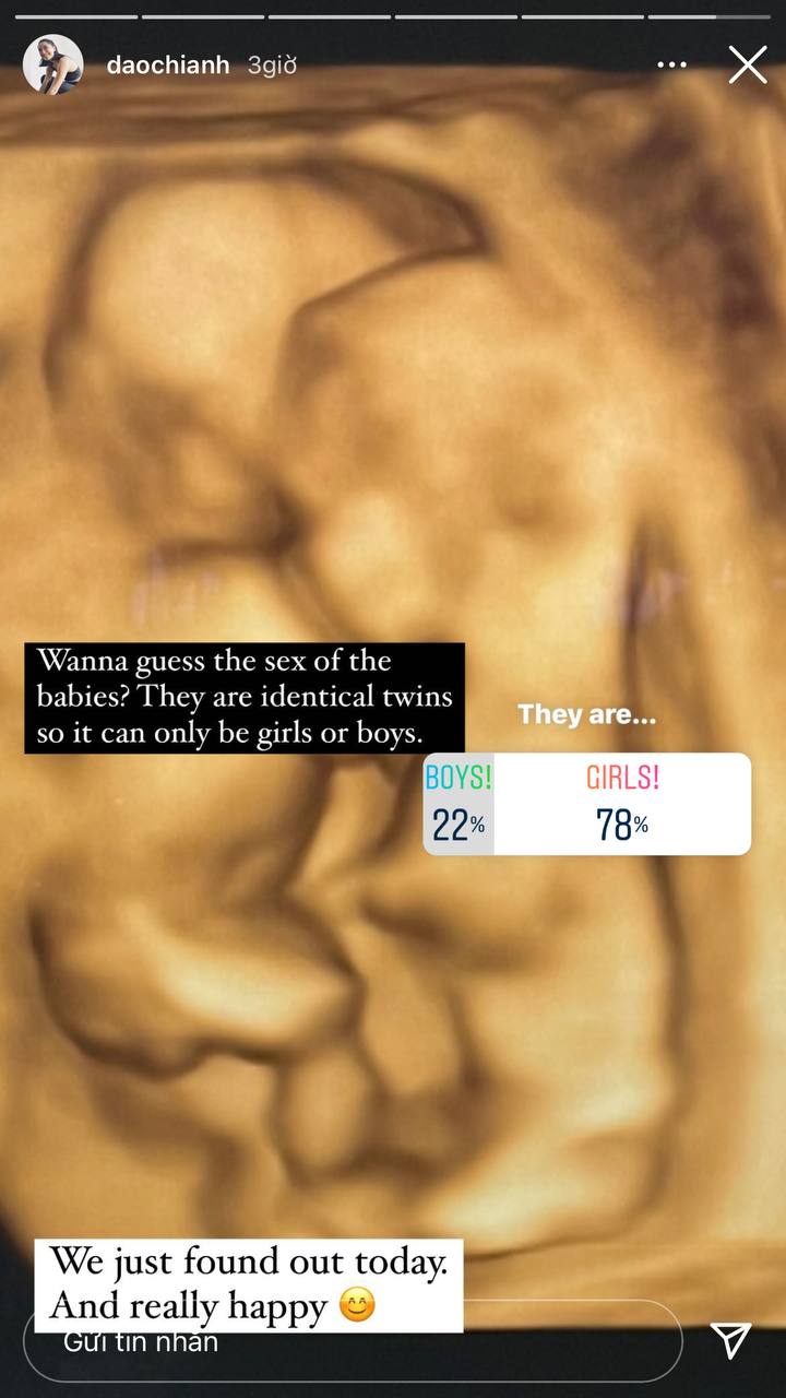 Thật bất ngờ, cựu CEO The KAfe Đào Chi Anh tiết lộ đang mang thai đôi, vừa biết giới tính 2 em bé - Ảnh 1. Thật bất ngờ, cựu CEO The KAfe Đào Chi Anh tiết lộ đang mang thai đôi, vừa biết giới tính 2 em bé - Ảnh 1.