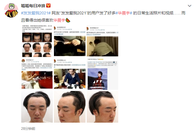 Hoa Thần Vũ bị &ldquo;t&igrave;nh cũ&rdquo; c&ocirc;ng khai h&igrave;nh ảnh cũ h&eacute; lộ chuyện &ldquo;n&acirc;ng mũi, gọt cằm&rdquo; - Ảnh 2.